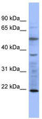 Myosin light chain 3 antibody, TA346031, Origene, Western Blot image 