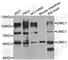 Ubiquitin Interaction Motif Containing 1 antibody, A7244, ABclonal Technology, Western Blot image 