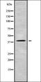 Radial Spoke Head 14 Homolog antibody, orb336271, Biorbyt, Western Blot image 