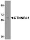 Catenin Beta Like 1 antibody, A05286, Boster Biological Technology, Western Blot image 
