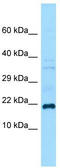 Gremlin 1, DAN Family BMP Antagonist antibody, TA346473, Origene, Western Blot image 