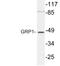 Cytohesin-3 antibody, LS-C177289, Lifespan Biosciences, Western Blot image 