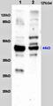 Coagulation Factor II Thrombin Receptor antibody, orb11234, Biorbyt, Western Blot image 
