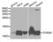 S100 Calcium Binding Protein A4 antibody, LS-C331598, Lifespan Biosciences, Western Blot image 