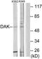 Triokinase And FMN Cyclase antibody, A30502, Boster Biological Technology, Western Blot image 