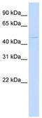 Zinc Finger And BTB Domain Containing 43 antibody, TA343718, Origene, Western Blot image 