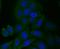 Sterol 26-hydroxylase, mitochondrial antibody, A02121, Boster Biological Technology, Immunocytochemistry image 