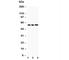Solute carrier family 2, facilitated glucose transporter member 9 antibody, R31287, NSJ Bioreagents, Western Blot image 