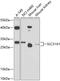Solute Carrier Family 31 Member 1 antibody, 13-433, ProSci, Western Blot image 