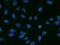BSD Domain Containing 1 antibody, 204061-T02, Sino Biological, Immunohistochemistry frozen image 