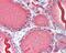 Thyroglobulin antibody, 49-491, ProSci, Immunohistochemistry paraffin image 