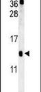Group XVI phospholipase A2 antibody, PA5-25650, Invitrogen Antibodies, Western Blot image 