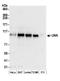 Unk Zinc Finger antibody, A304-713A, Bethyl Labs, Western Blot image 