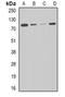 Carnitine O-palmitoyltransferase 2, mitochondrial antibody, orb340854, Biorbyt, Western Blot image 