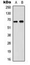 Probable ATP-dependent RNA helicase DDX5 antibody, LS-C355993, Lifespan Biosciences, Western Blot image 