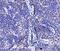 Podoplanin antibody, A01124-2, Boster Biological Technology, Immunohistochemistry paraffin image 