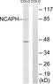 Non-SMC Condensin I Complex Subunit H antibody, LS-C119874, Lifespan Biosciences, Western Blot image 