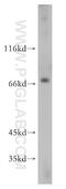 Very long-chain acyl-CoA synthetase antibody, 14048-1-AP, Proteintech Group, Western Blot image 