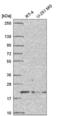 Dynactin Subunit 5 antibody, NBP2-57058, Novus Biologicals, Western Blot image 