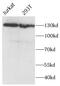 Partner And Localizer Of BRCA2 antibody, FNab06125, FineTest, Western Blot image 