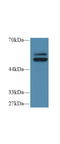 Protein Tyrosine Phosphatase Non-Receptor Type 5 antibody, LS-C712571, Lifespan Biosciences, Western Blot image 