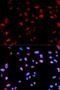 Renal carcinoma antigen NY-REN-26 antibody, orb153748, Biorbyt, Immunofluorescence image 