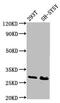 Regulatory Factor X Associated Ankyrin Containing Protein antibody, CSB-PA019617LA01HU, Cusabio, Western Blot image 