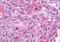 Neuromedin B Receptor antibody, orb85315, Biorbyt, Immunohistochemistry paraffin image 