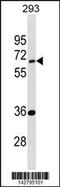 Enhancer Of MRNA Decapping 3 antibody, 60-966, ProSci, Western Blot image 