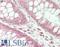 Cyclin-dependent kinase 13 antibody, LS-B14812, Lifespan Biosciences, Immunohistochemistry paraffin image 