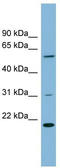 TP53RK Binding Protein antibody, TA345074, Origene, Western Blot image 