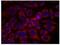 ERBB2 antibody, NB100-81960, Novus Biologicals, Immunocytochemistry image 
