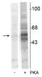 Tryptophan Hydroxylase 1 antibody, P01626-1, Boster Biological Technology, Western Blot image 