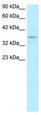 TATA-Box Binding Protein Associated Factor 7 antibody, TA330161, Origene, Western Blot image 