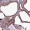 Round Spermatid Basic Protein 1 antibody, NBP1-83765, Novus Biologicals, Immunohistochemistry paraffin image 