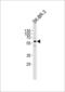 Cytochrome P450 Family 3 Subfamily A Member 5 antibody, LS-C96732, Lifespan Biosciences, Western Blot image 