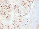 Plasma Cell Marker antibody, V9116-100UG, NSJ Bioreagents, Immunohistochemistry paraffin image 