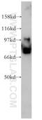 FMR1 Autosomal Homolog 1 antibody, 13194-1-AP, Proteintech Group, Western Blot image 