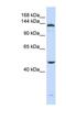 ADAM Metallopeptidase With Thrombospondin Type 1 Motif 18 antibody, NBP1-57095, Novus Biologicals, Western Blot image 