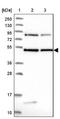 DENN Domain Containing 1B antibody, NBP2-47486, Novus Biologicals, Western Blot image 