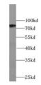 Sodium Channel Epithelial 1 Beta Subunit antibody, FNab09767, FineTest, Western Blot image 