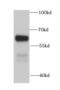 Mannosyl (Beta-1,4-)-Glycoprotein Beta-1,4-N-Acetylglucosaminyltransferase antibody, FNab05158, FineTest, Western Blot image 
