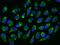 Tu Translation Elongation Factor, Mitochondrial antibody, GTX02214, GeneTex, Immunofluorescence image 