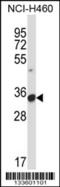 CD16 antibody, 57-101, ProSci, Western Blot image 