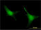 Prolyl Endopeptidase antibody, LS-C197979, Lifespan Biosciences, Immunofluorescence image 