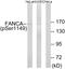FA Complementation Group A antibody, LS-C198953, Lifespan Biosciences, Western Blot image 