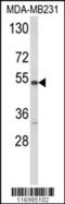 Cytochrome P450 2A13 antibody, 63-568, ProSci, Western Blot image 