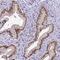 Survival Of Motor Neuron 2, Centromeric antibody, HPA045271, Atlas Antibodies, Immunohistochemistry frozen image 