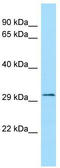 Feline Leukemia Virus Subgroup C Cellular Receptor Family Member 2 antibody, TA331252, Origene, Western Blot image 