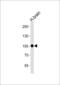 Cadherin 13 antibody, MBS9203283, MyBioSource, Western Blot image 